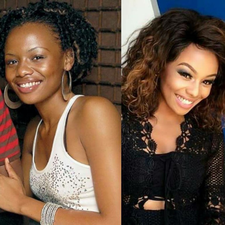 Mzansi Celebs Who Have Undergone Cosmetic Surgery