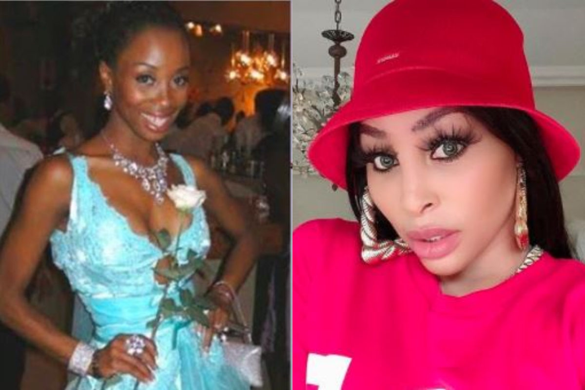 Mzansi Celebs Who Have Undergone Cosmetic Surgery