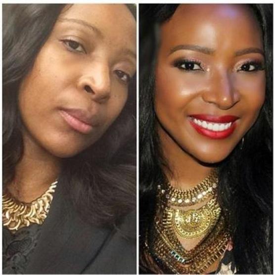 Mzansi Celebs Who Have Undergone Cosmetic Surgery