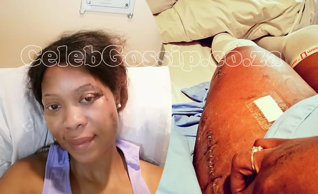 Skolopad becomes first SA celebrity to get Covid-19 vaccine after coronavirus nearly killed her