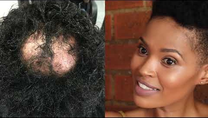 Gail Mabalane opens up on illness that is making all her hair fall