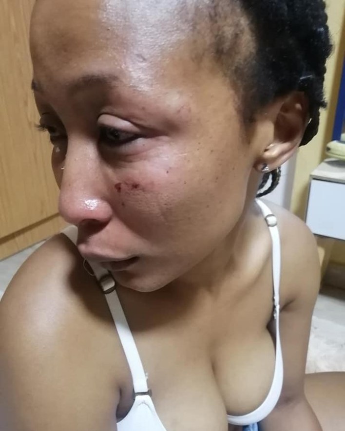 Former Idols SA Contestant Brutally Beaten-Up By Ex Boyfriend – Photos