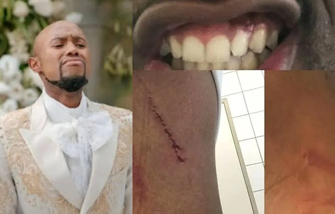 ‘Open a case against ‘abusive’ Somizi or keep quiet’ – Mohale told