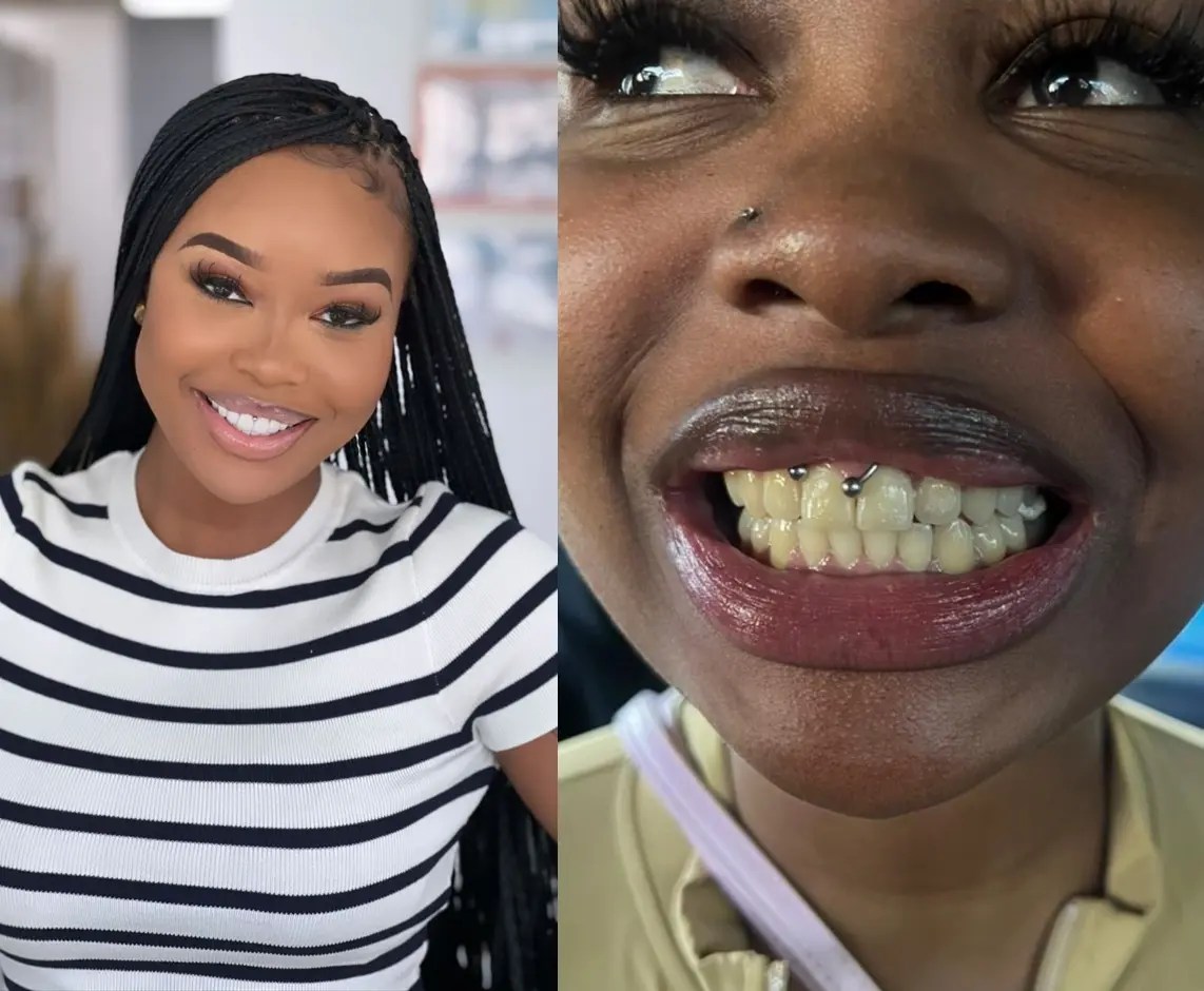 Sithelo Sithelo shows off her new set of teeth – South Africans react