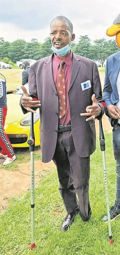 Actor Israel Matseke-Zulu bares his amputated leg