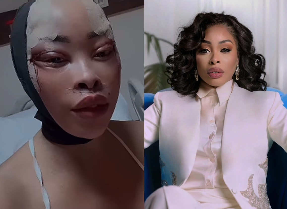 Video: Khanyi Mbau does another face surgery